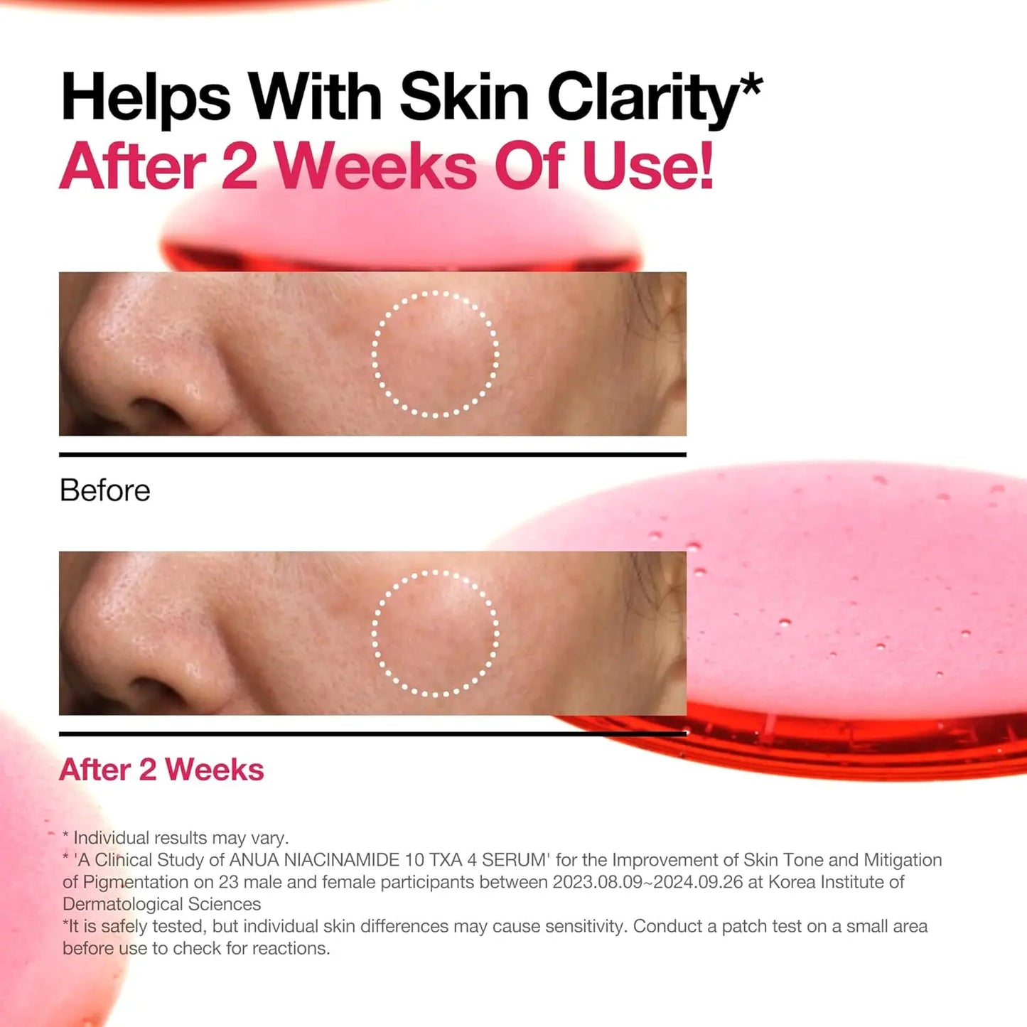 ANUA 10% Niacinamide+ 4% TXA Serum, Ceramide, Hyaluronic Acid, Tranexamic Acid, Vitamin B12 ,Fragrance-Free, Dark Spot , Korean Skincare